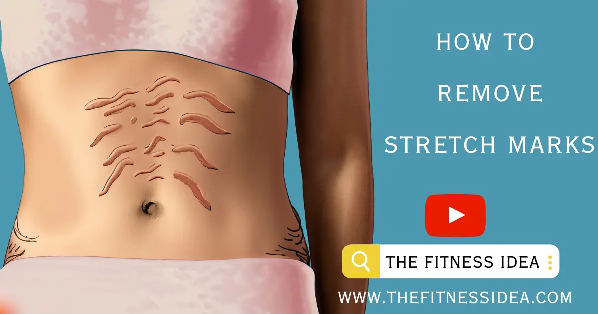 How To Remove Stretch Marks Do You Also Want To Remove